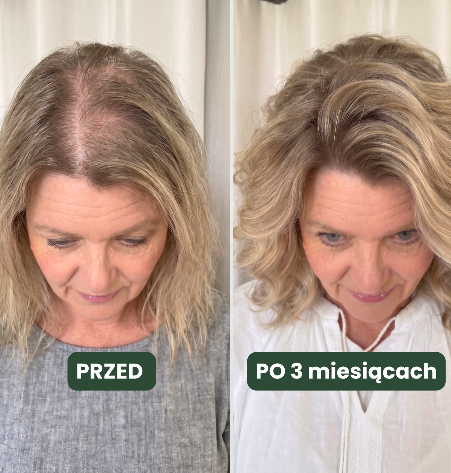 Profesjonalna kuracja trychologiczna Beyou