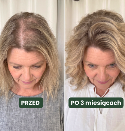 Profesjonalna kuracja trychologiczna Beyou